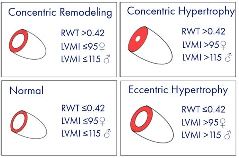 lvmi calculation.